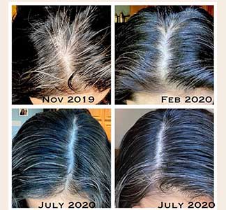 Women’s hair loss: Causes, Treatment, and Solutions 4 Photo from @beauty_unplugged